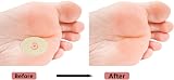 Siqian Corn Pads for Feet 30 Pcs Soft Latex Foam Cushions 2 Sheets 15 Pcs view 3