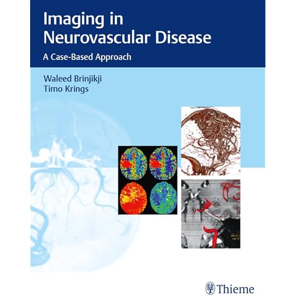 健康・医学 Decision Making in Neurovascular Disease Decision Making in Neurovascular Disease: jetzt bestellen im