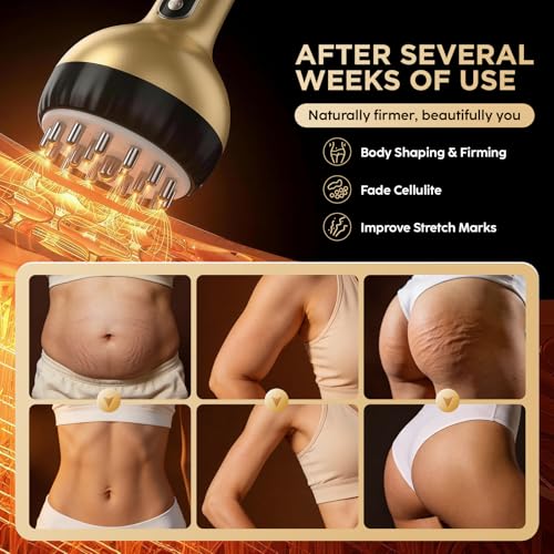 OVGIAP Lymphatic Drainage Massager & Anti-Cellulite Massage Tool, Body Sculpting Device for Legs, Arms & Stomach, Supports Smoother Skin, with Gentle Warming & Vibration (Gilded)