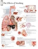 Effects of Smoking Educational Chart Poster 22 x 28in