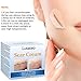 Scar Cream, Scar Treatment, Stretch Mark Cream, Scar Removal Cream, Acne Spots Treatment, Scar Cream for Face & Body, Old & New Scars from Cuts, C-Sections & Surgeries (35g)