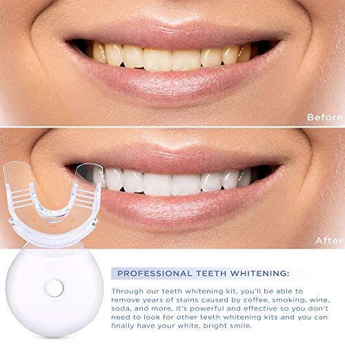 Premium Teeth Whitening System - LED Light, 35% Carbamide Peroxide, Reminerilization Gel - Beautiful White Smile - Thumbnail 4
