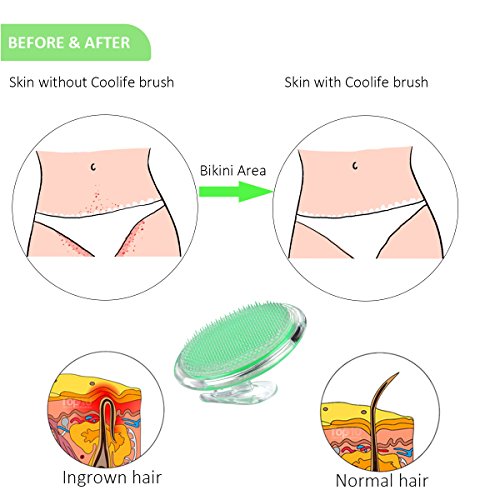 Coolife Ingrown Hair Remover And Razor Bumps Keratosis Pilaris