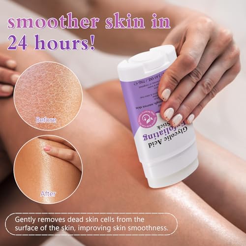 Glycolic Acid Exfoliating Body Stick 75g – With 7% Glycolic Acid & 0.5% Salicylic Acid, Helps Smooth Rough Skin, With Shea Butter, Gentle Body Exfoliation