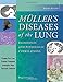 Muller's Diseases of the Lung: Radiologic and Pathologic Correlations
