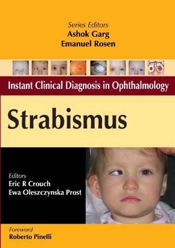 INSTANT CLINICAL DIAGNOSIS IN OPHTHALMOLOGY: STRABISMUS