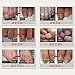 Ochine 30ML Fungal Treatment Essence Onychomycosis Fungal Remover Nail Feet Care Serum