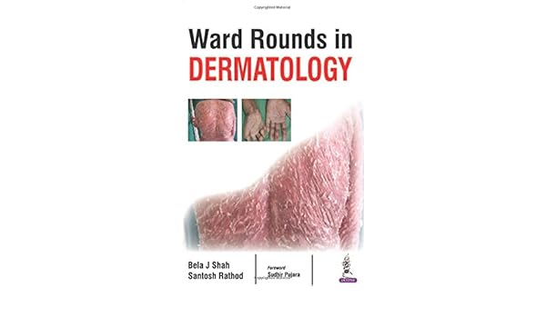 Ward Rounds In Dermatology 9789386322685 Medicine Health - 