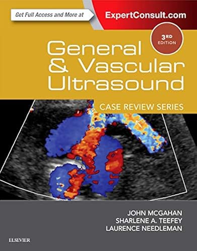 Download General and Vascular Ultrasound: Case Review PDF