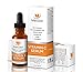 Vitamin C Serum For Face and Skin with 20% Vitamin C + E + Hyaluronic Acid – Our #1 BEST Serum to Fade Sun Spots & Discoloration – Rejuvenates & Brightens Skin – Guaranteed Glow! – 1oz (30ml)