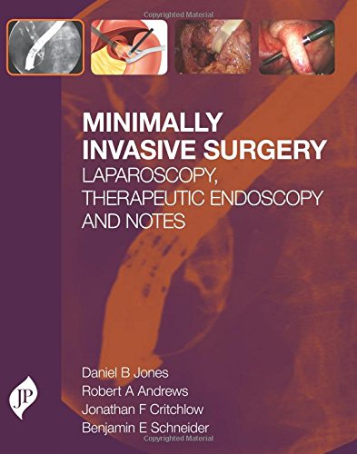 Minimally Invasive Surgery: Laparoscopy, Therapeutic Endoscopy and Notes Minimally Invasive Surgery: Laparoscopy, Therapeutic Endoscopy and Notes