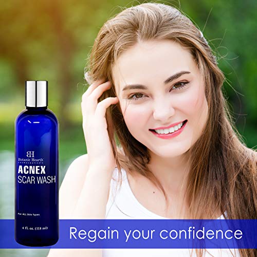 BOTANIC HEARTH Acnex Scar and Acne Wash Facial Cleanser for Acne