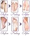 Foot Peel Mask - 2 Pack - For Cracked Heels, Dead Skin & Calluses - Make Your Feet Baby Soft & Get Smooth Silky Skin - Removes & Repairs Rough Heels, Dry Toe Skin
