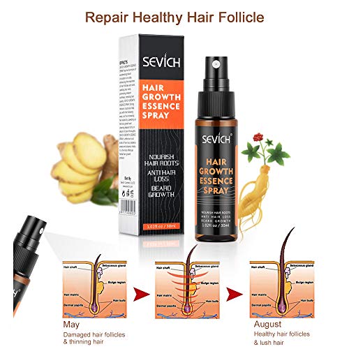 Hair Regrowth Spray, Anti Hair Loss, Thinning, Balding, Natural Ingredients Hair Regrowth Treatment for Stronger, Thicker, Longer Hair Grow,Repair Hair Follicles, All Hair Types, Men and Women