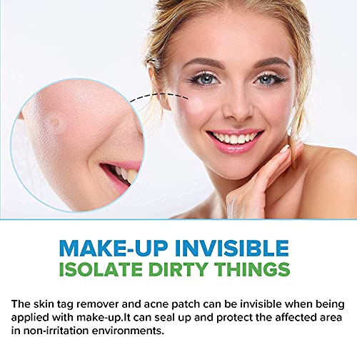 Skin Tag and Acne Remover Patches, Natural Ingredients, Advanced