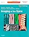 Imaging of the Spine: Expert Radiology Series, Expert Consult-Online and Print, 1e