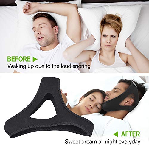 LUCCO Anti Snoring Chin Strap,Adjustable Anti Snoring Devices Better Sleep Helper,Snore Reducing Aids Snore Stopper Chin Straps for Men & Women (Black)