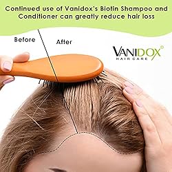 VANIDOX Routine Shampoo and Conditioner for