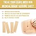 HANASCAR Professional Silicone Scar Removal Sheets, Treat Scars Caused by C-Section, Surgery, Burn, Injuries, Acne, and Stretch Marks, Works on Old & New Scars, 5.7
