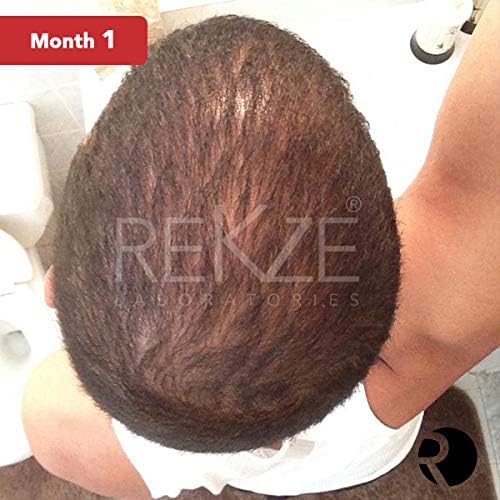 REKZE 63 Hair Growth Shampoo, Clinically Proven w/Caffeine, Biotin, Saw Palmetto, Thickening Therapy For Men & Women - Image 5