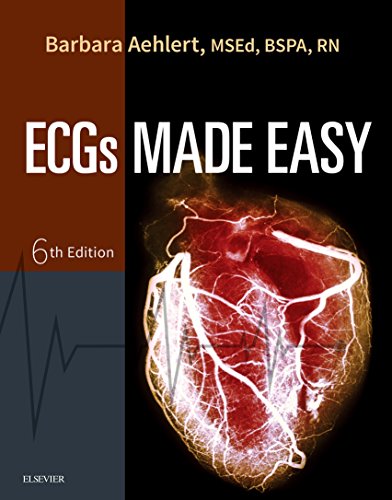 ECGs Made Easy - E-Book - //medicalbooks.filipinodoctors.org