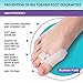 Bunion Corrector and Bunion Relief Kit - 7 Piece Set - 2 Sleeves with Gel Pad - 2 Toes Spacers with Hallux Valgus Shield - 2 Big Toe Separators - 1 Blister and Corn Tube - Hammer Toe Straightener
