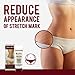 Stretch Marks and Scar Removal Cream | Natural Pregnancy Stretch Mark, Scars and Skin Repair Treatment | Hydration, Exfoliation, Tightening, Collagen Boost | Belly Care for Pre-natal Post-natal | 1 pc