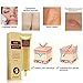 Scar Cream, Acne Scar Removal Cream,Acne Spots Treatment,Stretch Marks Relief and Burns Repair,Face Skin Repair Cream 30ml