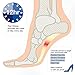 The Original X Brace - Arch Support Brace and Compression for Plantar Fasciitis, Sever's Disease, Flat Feet, Fallen Arches, Over-Pronation and Heel Pain, Logo Free - XSmall