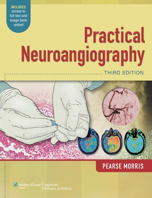 Decision Making in Neurovascular Disease: 9781684200573: Medicine