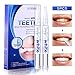 Teeth Whitening Pen Kit(5 Pens), Safe 35% Carbamide Peroxide Gel, Effective, Painless, No Sensitivity, Easy to Use, Travel-Friendly, 20+ Uses, Beautiful White Smile, Natural Mint Flavor