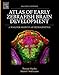 Atlas of Early Zebrafish Brain Development, Second Edition: A Tool for Molecular Neurogenetics