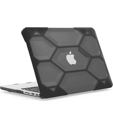 Amazon.com: UESWILL 3in1 kit Case for MacBook Pro (Retina, 13 inch