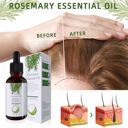 Rosemary Oil For Hair, Natural Rosemary Oil Hair Growth, Rosemary Oil For Women And Men, Nourishes Scalp (60ML)