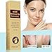 Scar Cream, Acne Scar Removal Cream,Acne Spots Treatment,Stretch Marks Relief and Burns Repair,Face Skin Repair Cream 30ml