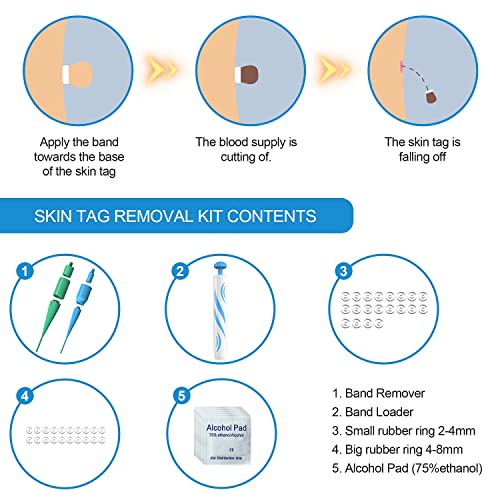 Skin Tag Removers, 2in1 Skin Tag Removal Kit Tools for Small to Large (2mm 8mm) Skin Tags