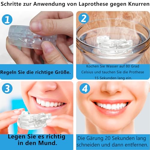 DOHUG Snore Splint, Adjustable Bite Splint Against Snoring and Crunching - Anti Snoring Snoring Stopper - Anti-Snoring Mouth Guard - Improves Sleep Quality (White Medium)