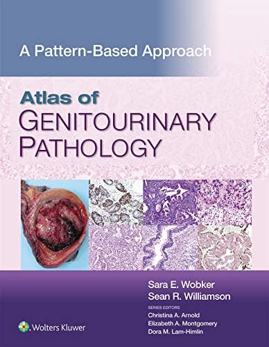 Amazon.com: Hinman's Atlas of Urologic Surgery Revised Reprint