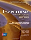Lymphedema Understanding and Managing Lymphedema After Cancer Treatment by American Cancer Society [American Cancer Society,2006] [Paperback]