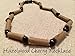 Hazelwood eczema acid reflux colic 12.5 to 13 inch Necklace Black Cherry for babies baby infant toddler bub for Gut issues; GERD, heartburn, and ulcers. Baltic Essentials