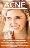 Acne: The Ultimate Guide On How To Both Prevent And Get Rid Of Your Blemishes To Regain Your Clear S by Stan Kozak