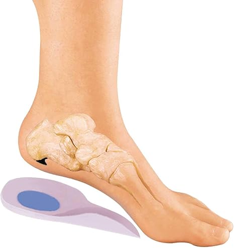 large bone spur on heel