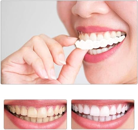 Denti Temporanei Cosmetici Faccette Dentali Sorriso Perfetto Sbiancamento Dentiera Denti Perfetti For Tutti 2 Pezzi Set Denti Superiori E Inferiori Amazon It Salute E Cura Della Persona