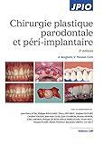 Chirurgie Plastique Parodontale Et Péri-implantaire (French Edition) by
