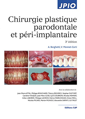 Chirurgie Plastique Parodontale Et Péri-implantaire (French Edition) by V. Monnet-Corti, A. Borghetti