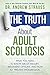 The Truth About Adult Scoliosis: What You Need to Know About History, Treatment Options, and How to Prevent Progression