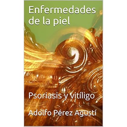 Enfermedades de la piel: Psoriasis y vitíligo (Tratamiento natural nº 43) Enfermedades de la piel: Psoriasis y vitíligo (Tratamiento natural nº 43)