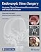 Endoscopic Sinus Surgery: Anatomy, Three-Dimensional Reconstruction, and Surgical Technique