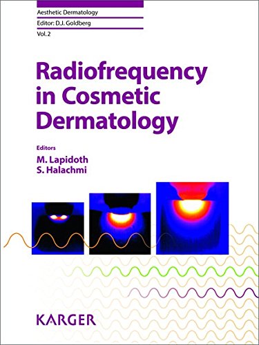 Radiofrequency in Cosmetic Dermatology (Aesthetic Dermatology, Vol. 2)From S. Karger