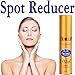 I Max Age Spot Reducer & Preventer fortified by Nanoliposome, Stem Cell, Peptides, Melatonin, AHA, Vitamin A, B-3, C, E, Phloretin CF, Glutathinone, Tranexamic Acid & Licorice for Lightening & Evening Skin, Fading Pigmentation, Brown & Liver Spots, Acne Scars & Freckles for men and women.